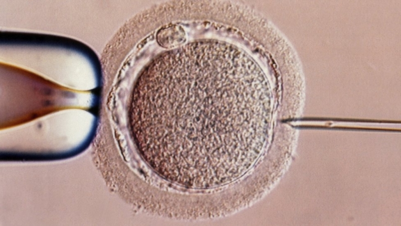 Бебе с трима родители се роди в Гърция съобщи Би