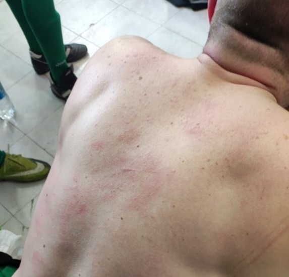 Полицай от Районното управление в Оряхово е бил пребит жестоко