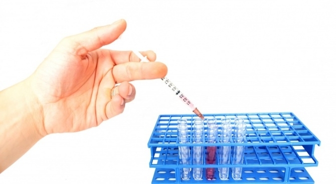 Имунолози от университета в Монреал извършиха първите лабораторни тестове с