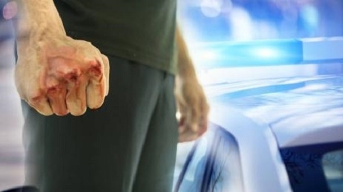 Младеж пренощува в ареста след като изби два зъба на