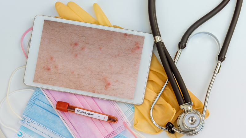 Правителството на САЩ увеличава усилията си за спиране на разпространението