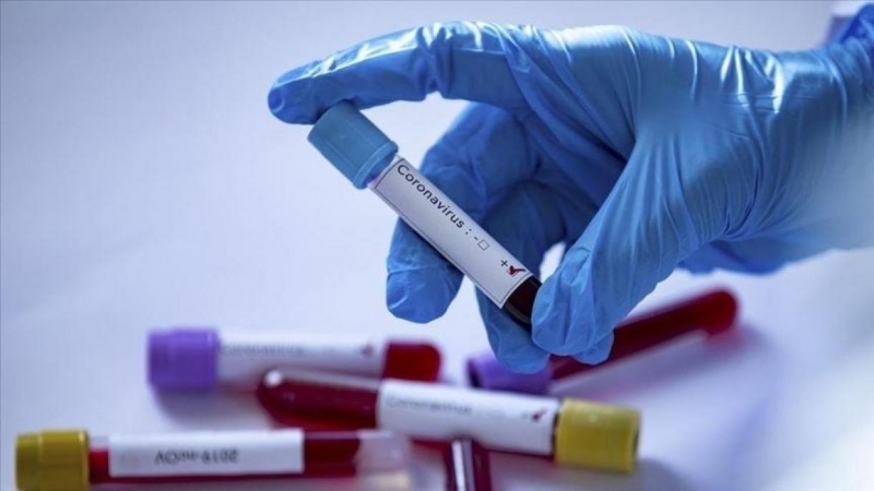 Новите случаи на коронавирус у нас при направени 2840 теста