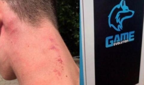 Поредно нагло безобразие се случило в столицата Малолетно момче от