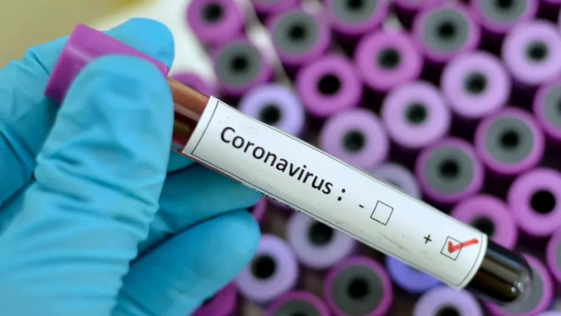 816 са новодиагностицираните с коронавирусна инфекция лица през изминалите 24