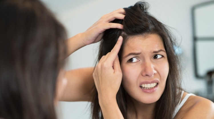 Пърхотът е сухо люспесто състояние на кожата на скалпа Eто