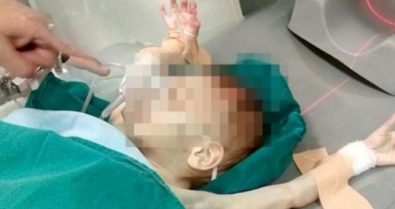 Габи едвам се изправя но не може да ходи прекалено