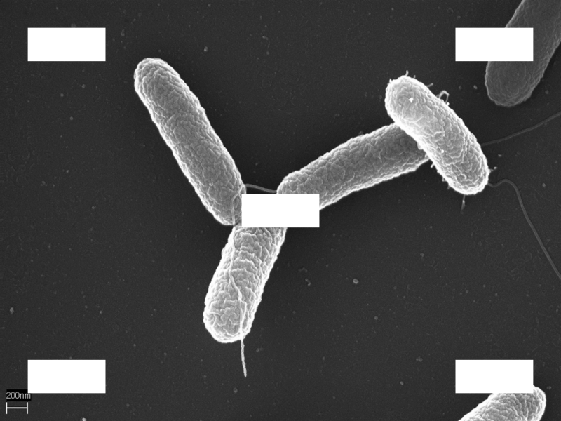 Пет заразни заболявания са регистрирани от здравните власти в област