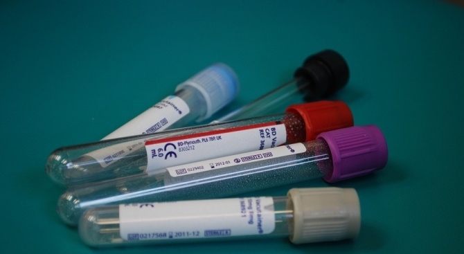 Едва 20 на 1000 души у нас даряват кръв което