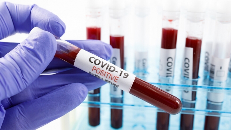 Още 8 нови случая на коронавирус у нас За тях