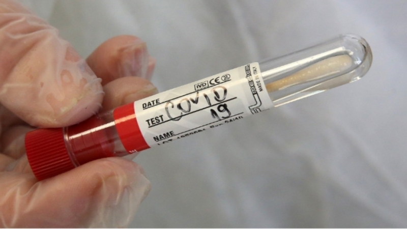 497 са новодиагностицираните с коронавирусна инфекция лица през изминалите 24