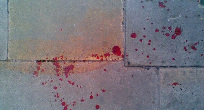 Младеж е прострелян в гърдите в Монтана това предадоха от