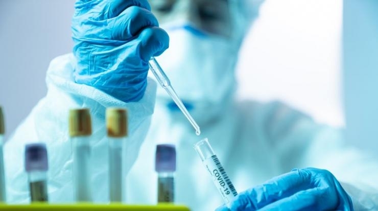 327 са новодиагностицираните с коронавирусна инфекция лица през изминалите 24