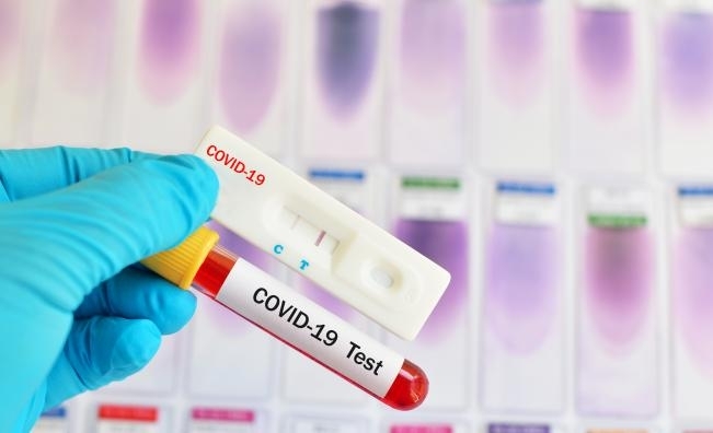 Белодробното отделение на болницата в Кърджали е затворено за дезинфекция