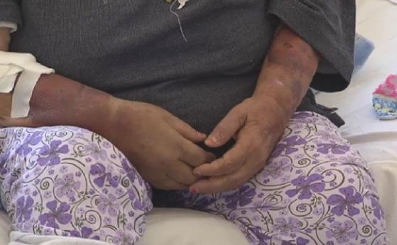 Баба в монтанската болница след като пребита от лют съсед