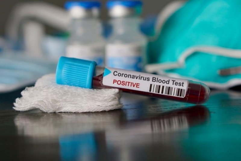 Китай съобщи за 48 нови случая на заразяване с коронавирус,