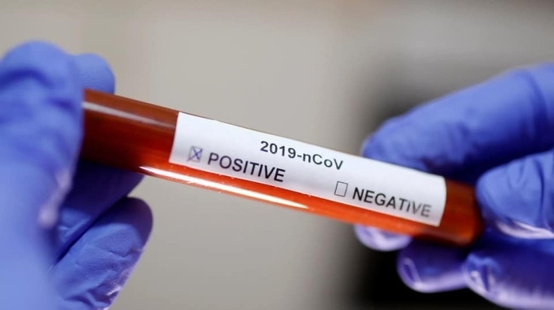 Новите потвърдени случаи на коронавирус у нас за последното денонощие са