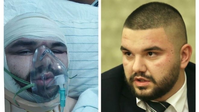 Македонският българин Христо Пендиков който бе пребит на 19 януари