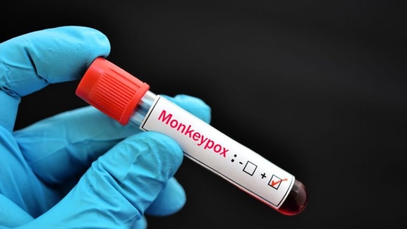 Китайският град Чунцин съобщи за един случай на заразяване с