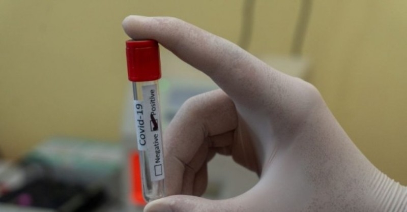 1141 са новите случаи на коронавирус през последното денонощие у