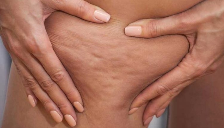 Диетологът Любов Пищалкина разказа в няколко стъпки как да се