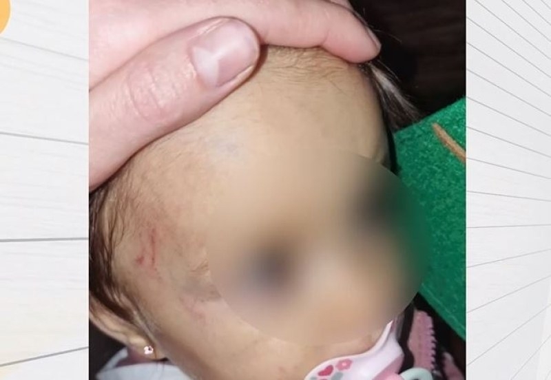 Дете на годинка е с травма на главата след посещение на частна занималня в София /видео/