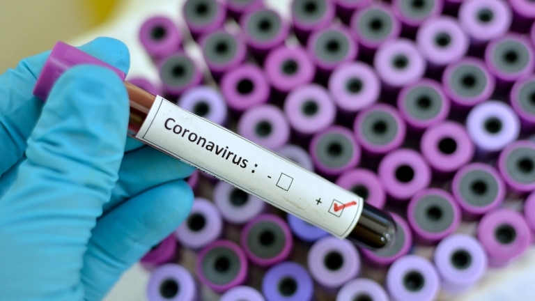 53 са новодиагностицираните с коронавирусна инфекция през изминалите 24 часа