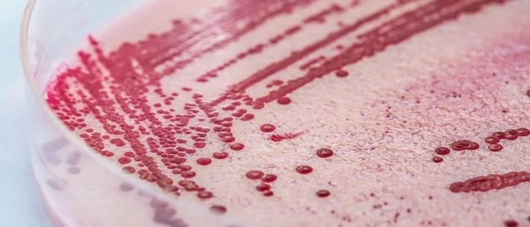 Епидемия от листериоза бактерията в свинското месо е установена