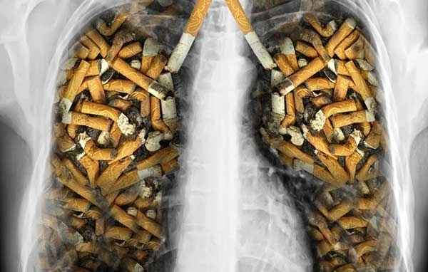 С раздаване на брошури в Монтана отбелязаха 31 май Световния