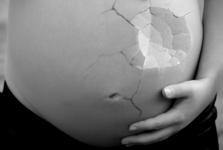 Всяка десета жена на света е преживяла спонтанен аборт и
