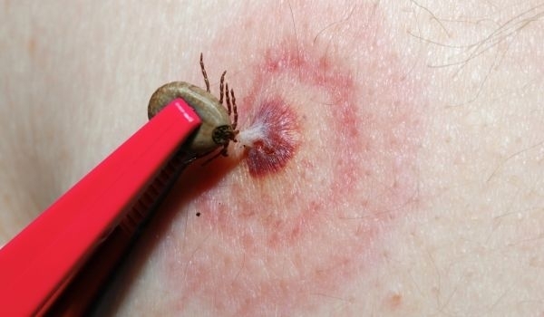 Бум на активността на кърлежите в цялата страна Много хора