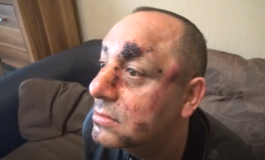 Брутално нападение! Тираджии пребиха и ограбиха мъж от Видин, карал бавно /видео/