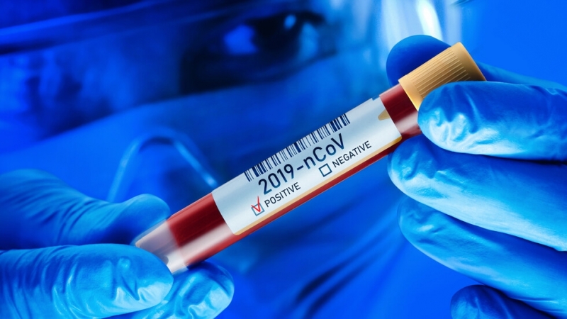 Четири са новите случаи с потвърден COVID 19 в Монтана през