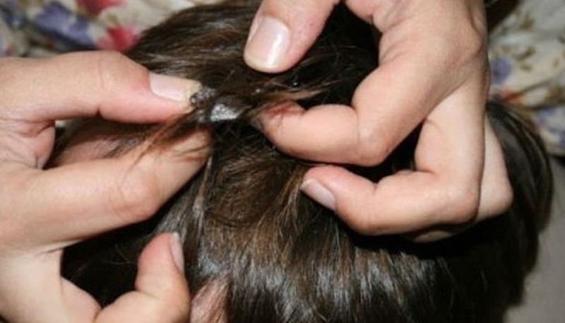 Здравните инспектори от Монтана следят под лупа децата от областта