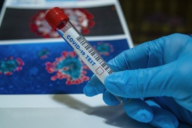 Два нови варианта на COVID-19, случаите у нас се увеличават