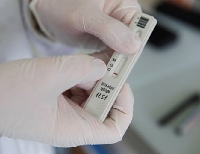 Броят на потвърдените случаи на коронавируса в Германия се е