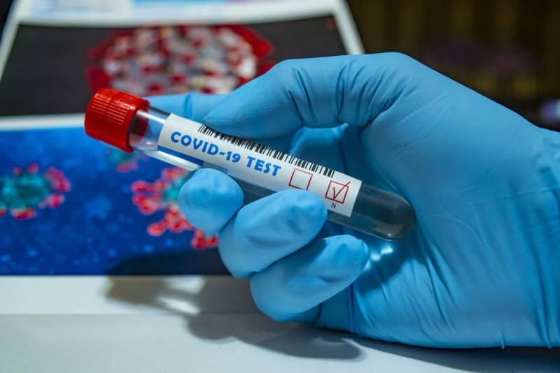 155 са новите случаи на коронавирус през последното денонощие в