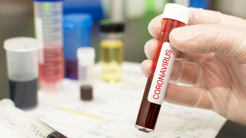 182 са новите случи на заразени с коронавирус в България