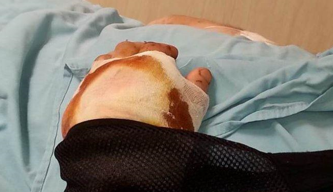 39 годишен мъж от благоевградското село Церово е транспортиран в полунощ