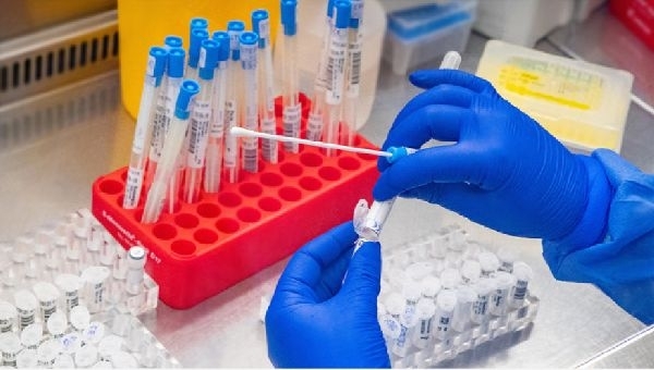 Новите случаи на коронавирус у нас за последното денонощие са