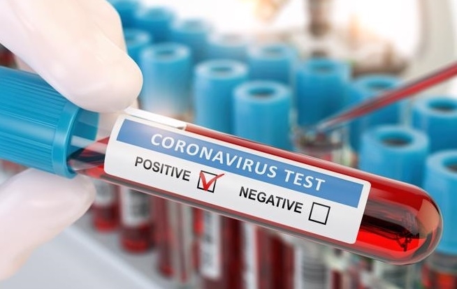 90 нови случаи на заразени с COVID 19 са регистрирани в