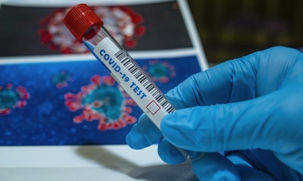 Притеснителен рекорд удари вчерашният 26 юни за статистиката на заразените