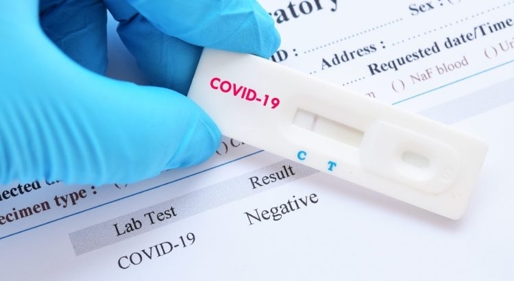 497 са новите случаи на COVID 19 през последното денонощие с