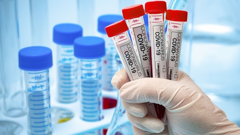 5256 са потвърдените нови болни от коронавирус за последните 24