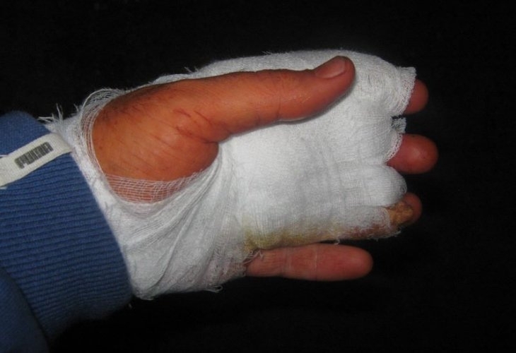 Разследват трудова злополука в Русе съобщиха от полицията За случая е било