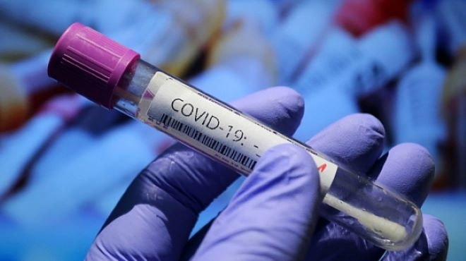 46 са новите случаи на COVID 19 в България за последните 24