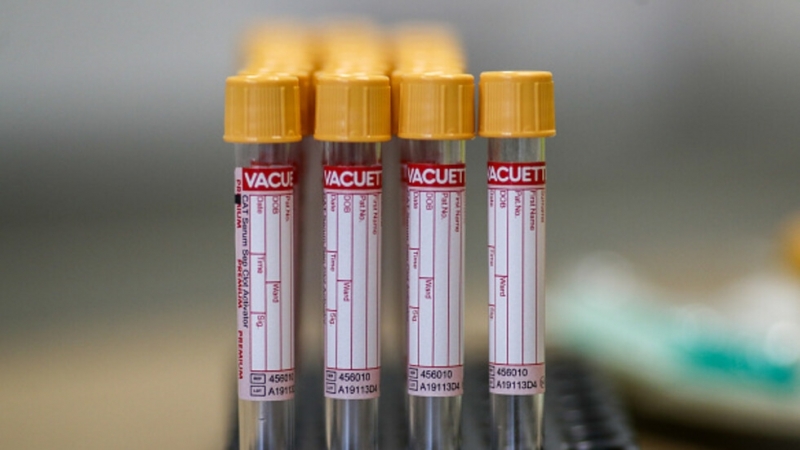 Месопреработвателен завод в западния регион Тимиш в Румъния преустанови работа