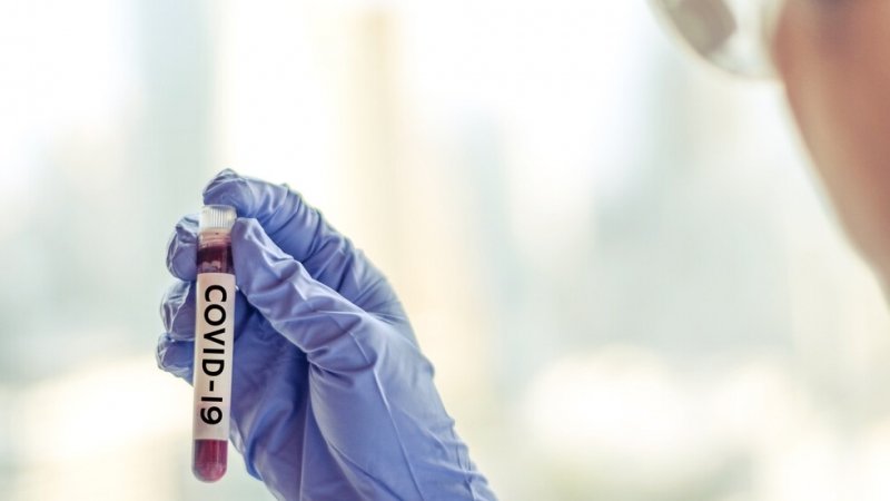 Почина 74 годишният заразен с коронавирус мъж който беше настанен в