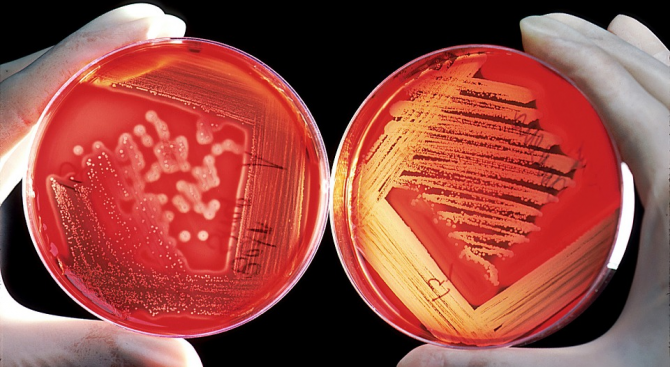 Около 70 процента от микробите на Земята живеят в нейните