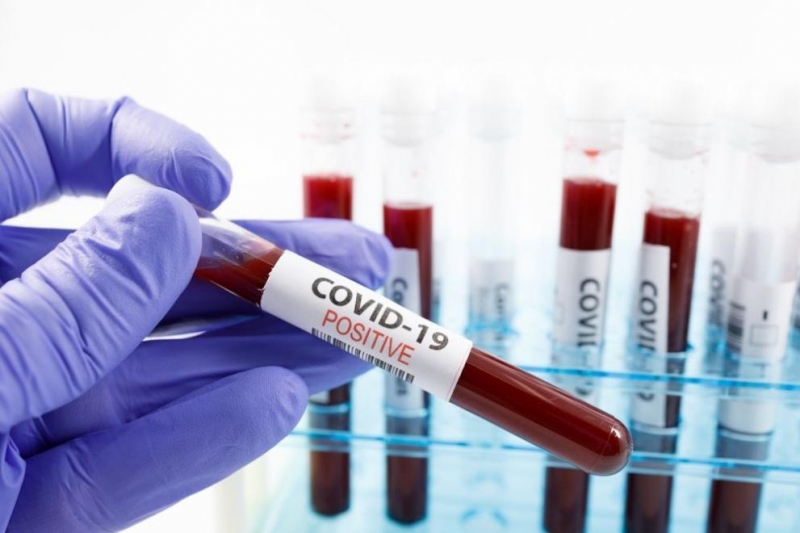 В област Видин има регистрирани 2 нови случая на коронавирус