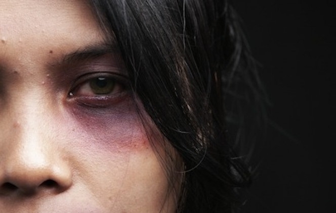 Мъж е нокаутирал с един удар гостенка в собствения му